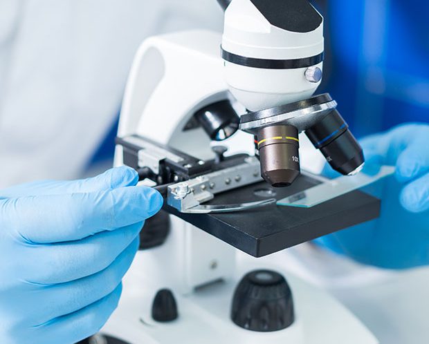 SSD Caluanie Chemicals